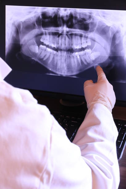 Best Emergency Treatment for Oral Infections in Cicero, IN