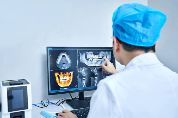 Best Broken or Chipped Tooth Repair in Cicero, IN